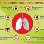 ЩО НЕОБХІДНО ЗНАТИ ПРО ТУБЕРКУЛЬОЗ