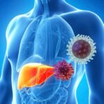 ВІРУСНІ ГЕПАТИТИ